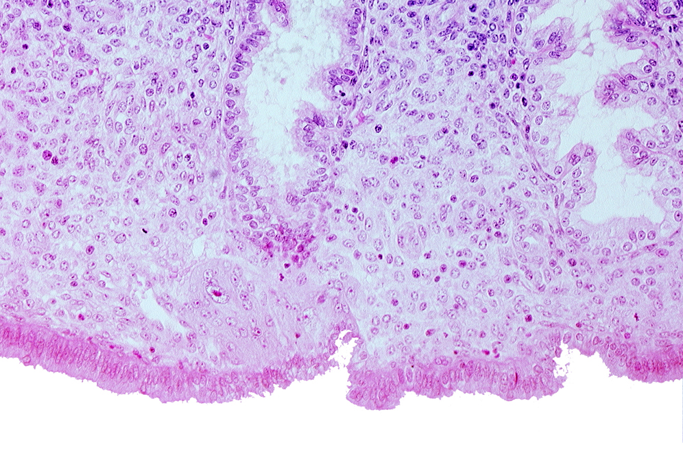 edematous endometrial stroma (decidua), syncytiotrophoblast, uterine cavity