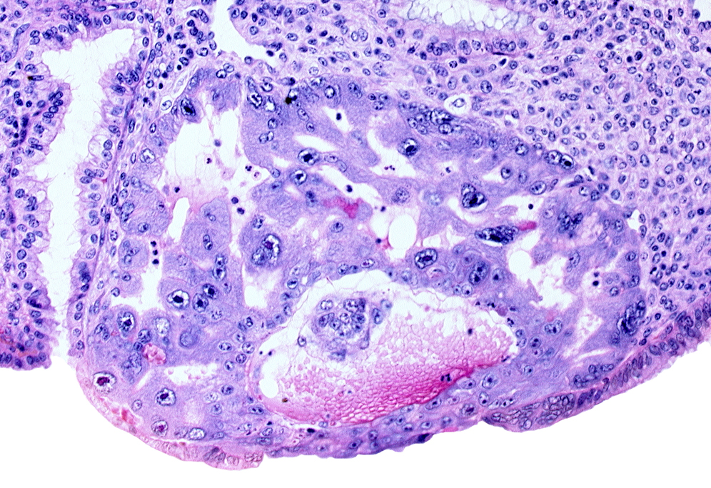 cytotrophoblast, disrupted endometrial epithelium, endometrial epithelium, primary umbilical vesicle cavity, syncytiotrophoblast