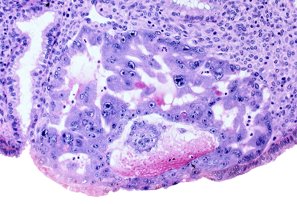 amnioblast(s), cytotrophoblast, disrupted endometrial epithelium, endometrial epithelium, epiblast, extra-embryonic endoblast, hypoblast, primary umbilical vesicle cavity, syncytiotrophoblast