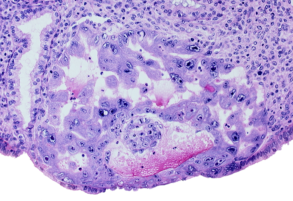 endometrial sinusoid, intercommunicating lacunae, lumen of endometrial gland