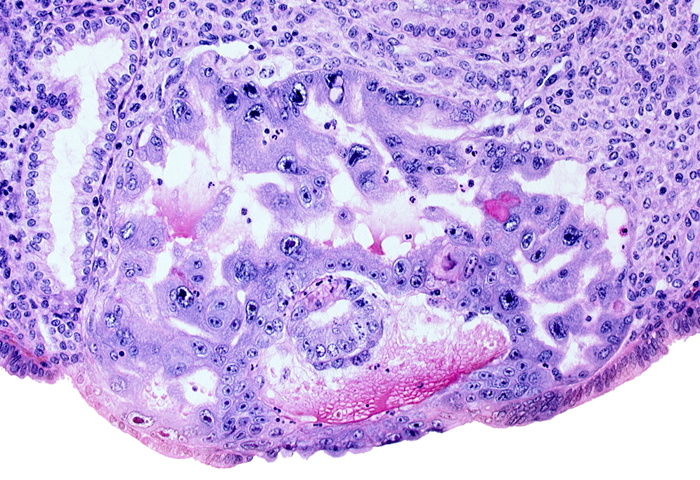 amnioblast(s), cytotrophoblast, edge of amniotic cavity, endometrial sinusoid, epiblast, hypoblast, intercommunicating lacunae, lumen of endometrial gland, syncytiotrophoblast