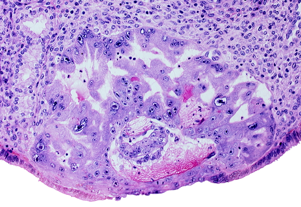 amniotic cavity, epiblast, hypoblast, maternal blood cells in primary umbilical vesicle cavity