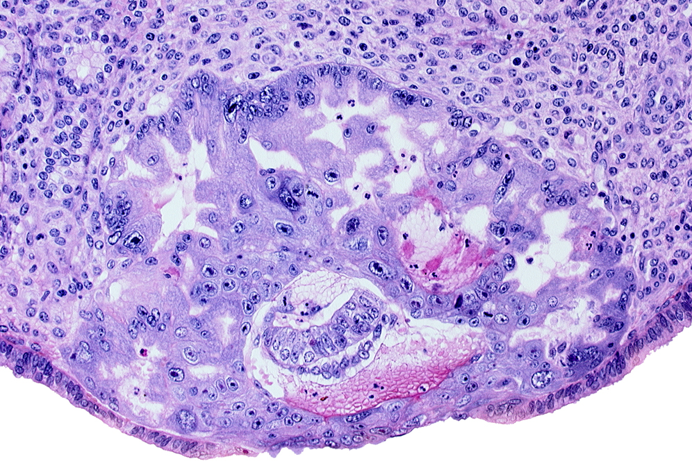 amnioblast(s), amniotic cavity, cytotrophoblast, epiblast, extra-embryonic endoblast, hypoblast, maternal blood cells in primary umbilical vesicle cavity, syncytiotrophoblast