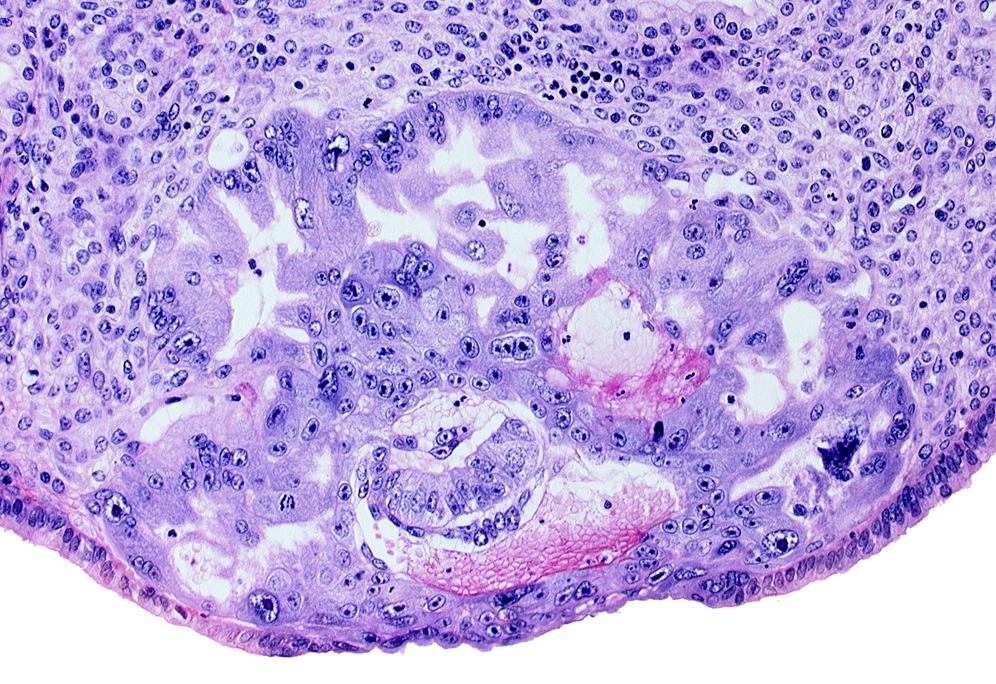 amnioblast(s), amniotic cavity, cytotrophoblast, degenerated endodermal epithelium, endometrial sinusoid, epiblast, hypoblast, intercommunicating trophoblastic lacunae, maternal blood cells in primary umbilical vesicle cavity, syncytiotrophoblast