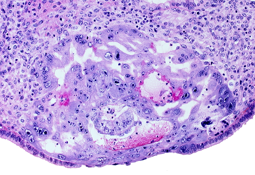 amnioblast(s), cytotrophoblast, edge of amniotic cavity, embryonic disc, endometrial epithelium, previllus clump of cytotrophoblast, syncytiotrophoblast, uterine cavity