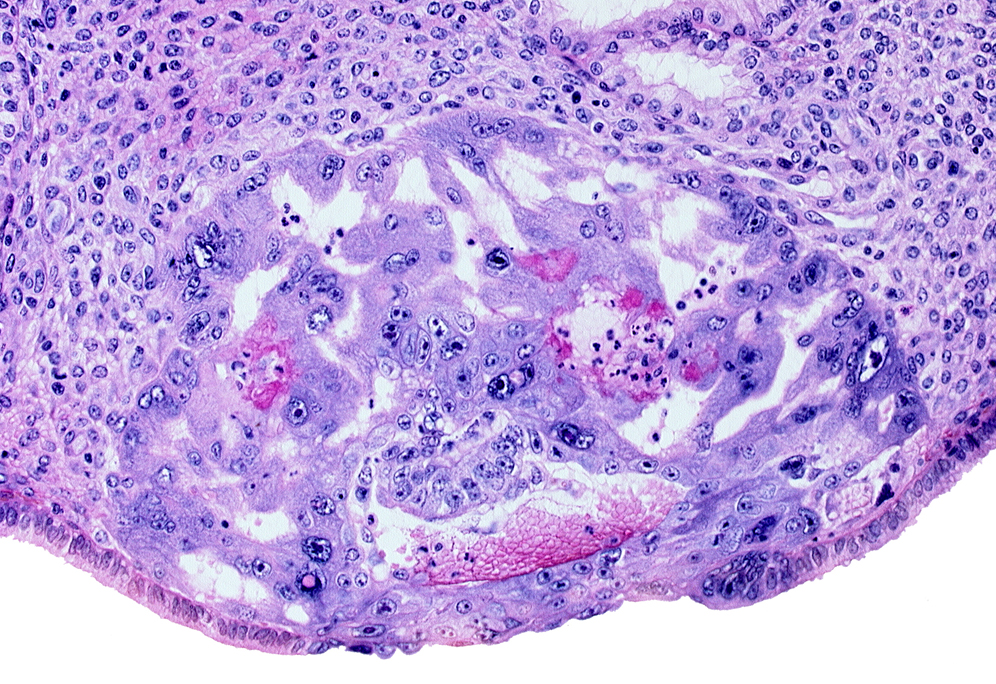 amnioblast(s), disrupted endometrial gland cells, epiblast, extra-embryonic endoblast applied to trophoblast, intact endometrial epithelium, syncytiotrophoblast