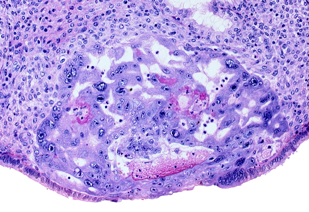 disrupted endometrial epithelium, intact endometrial epithelium, maternal blood cells in primary umbilical vesicle cavity