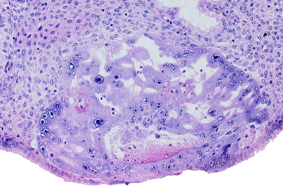 extra-embryonic mesoblast, maternal blood cells in primary umbilical vesicle cavity, primary umbilical vesicle cavity