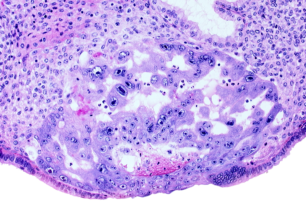 maternal blood cells in primary umbilical vesicle cavity, primary umbilical vesicle cavity