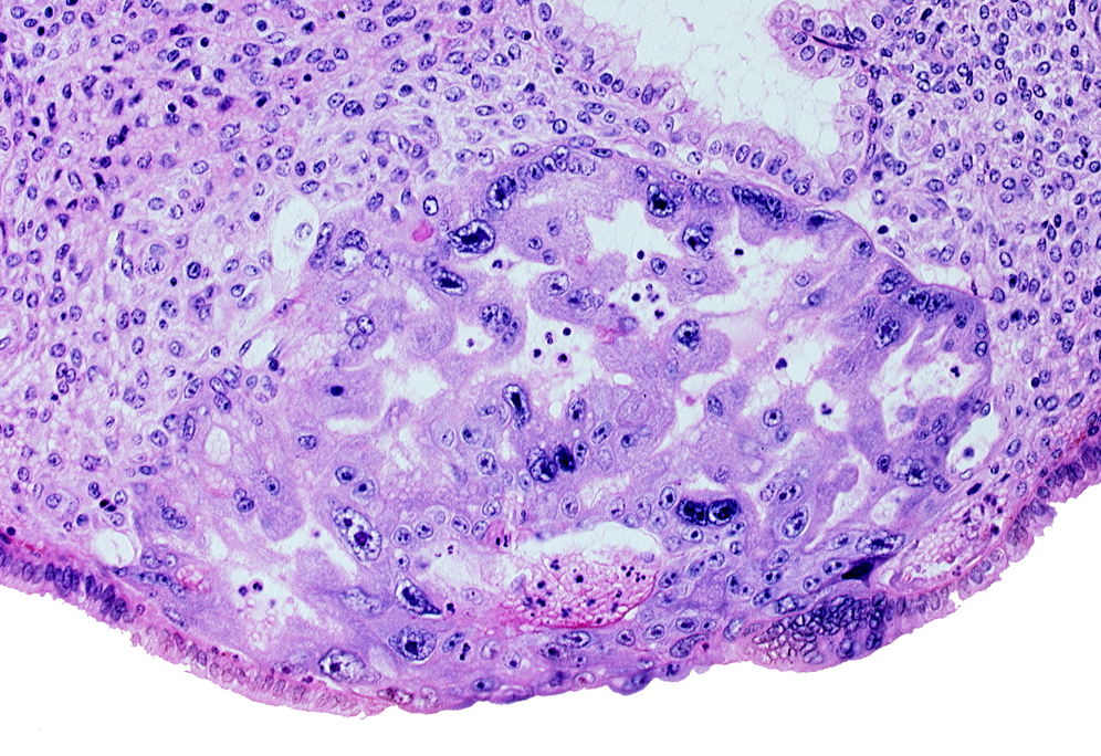 endometrial epithelium, endometrial sinusoid, primary umbilical vesicle cavity, uterine cavity