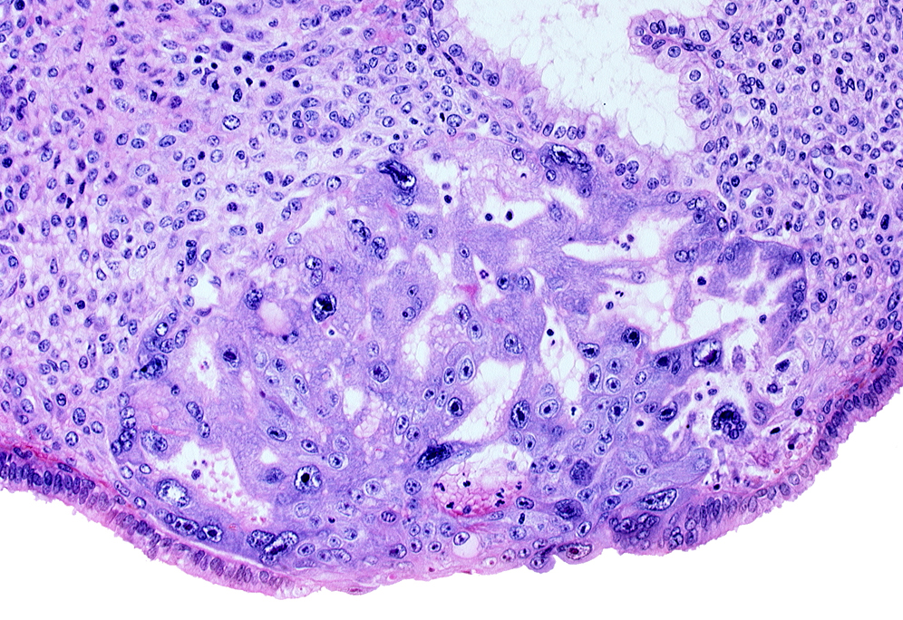 cytotrophoblast, edge of primary umbilical vesicle cavity, intercommunicating lacunae, syncytiotrophoblast, uterine cavity