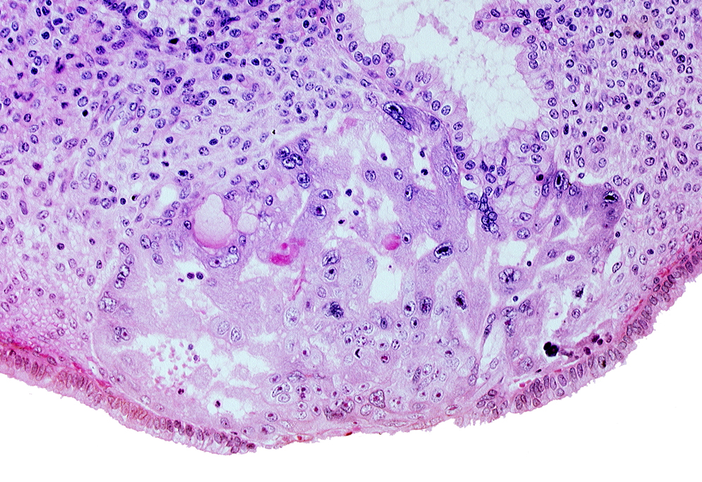 degenerated endodermal epithelium, intercommunicating lacunae, lumen of endometrial gland, uterine cavity