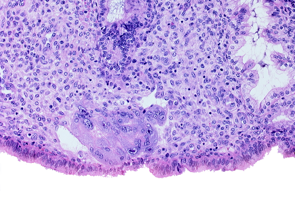 endometrial gland, endometrial sinusoid, intact endometrial epithelium, syncytiotrophoblast, uterine cavity