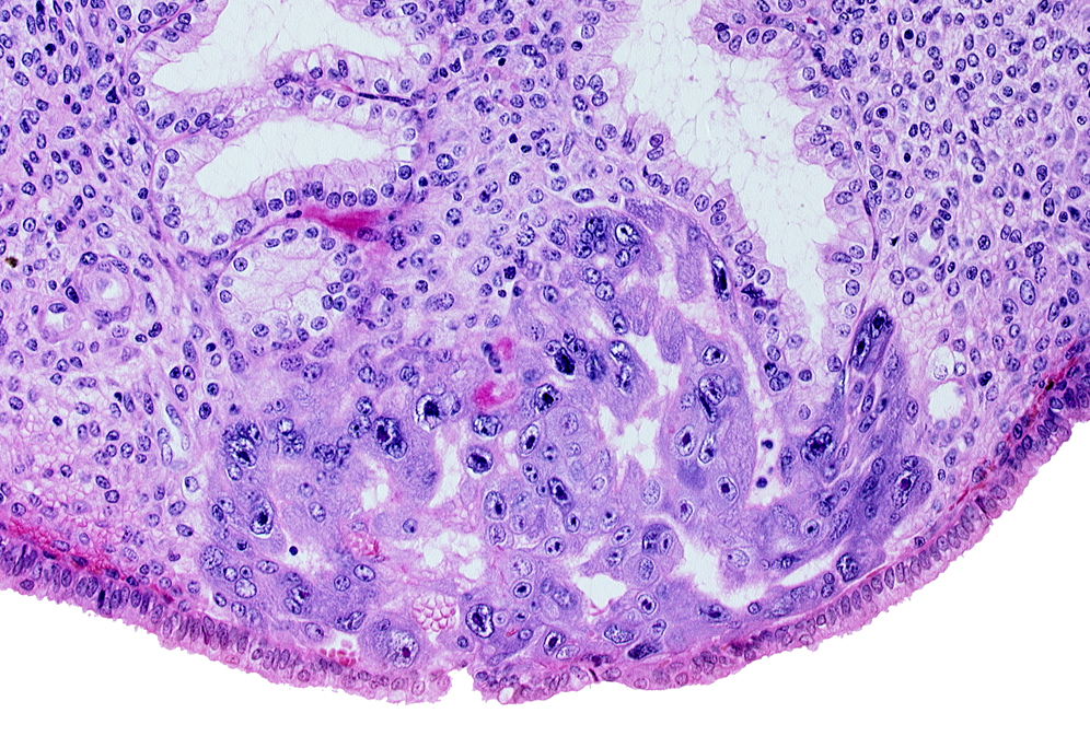 endometrial gland, endometrial sinusoid, intercommunicating lacunae, lumen of endometrial gland, uterine cavity