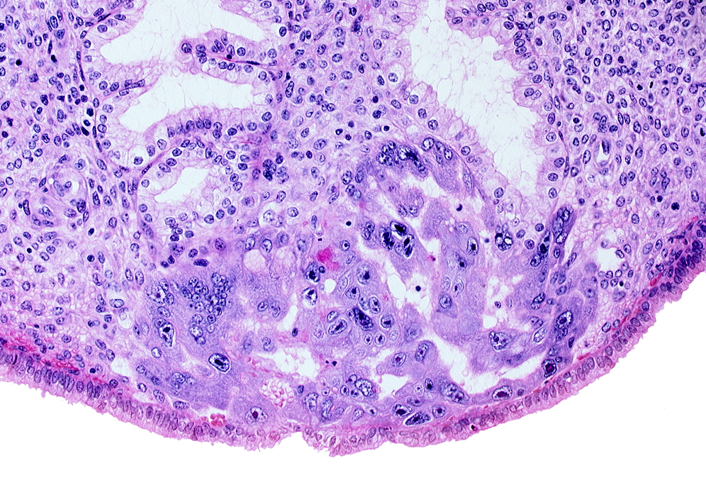 endometrial sinusoid, intercommunicating lacunae, lumen of endometrial gland, syncytiotrophoblast, uterine cavity