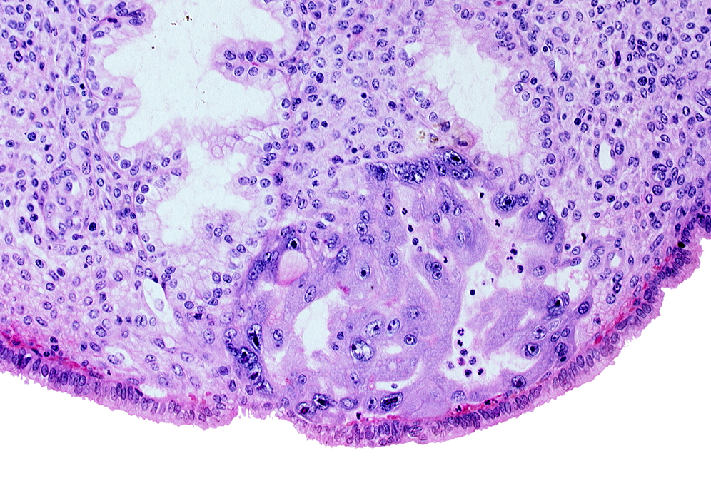 endometrial sinusoid, intact endometrial epithelium, lumen of endometrial gland, maternal blood cells in intercommunicating lacunae, uterine cavity