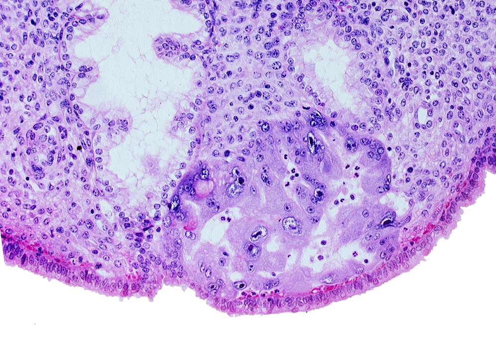 endometrial sinusoid, intact endometrial epithelium, lumen of endometrial gland, maternal blood cells in intercommunicating lacunae, syncytiotrophoblast, uterine cavity