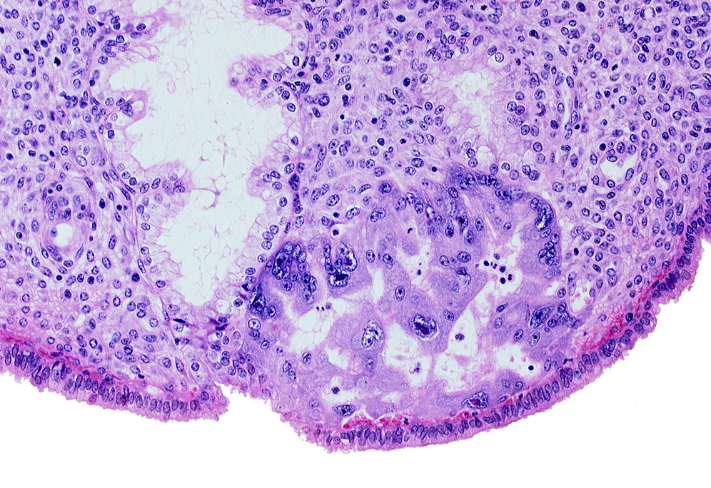 endometrial epithelium, endometrial sinusoid, maternal blood cells in intercommunicating lacunae