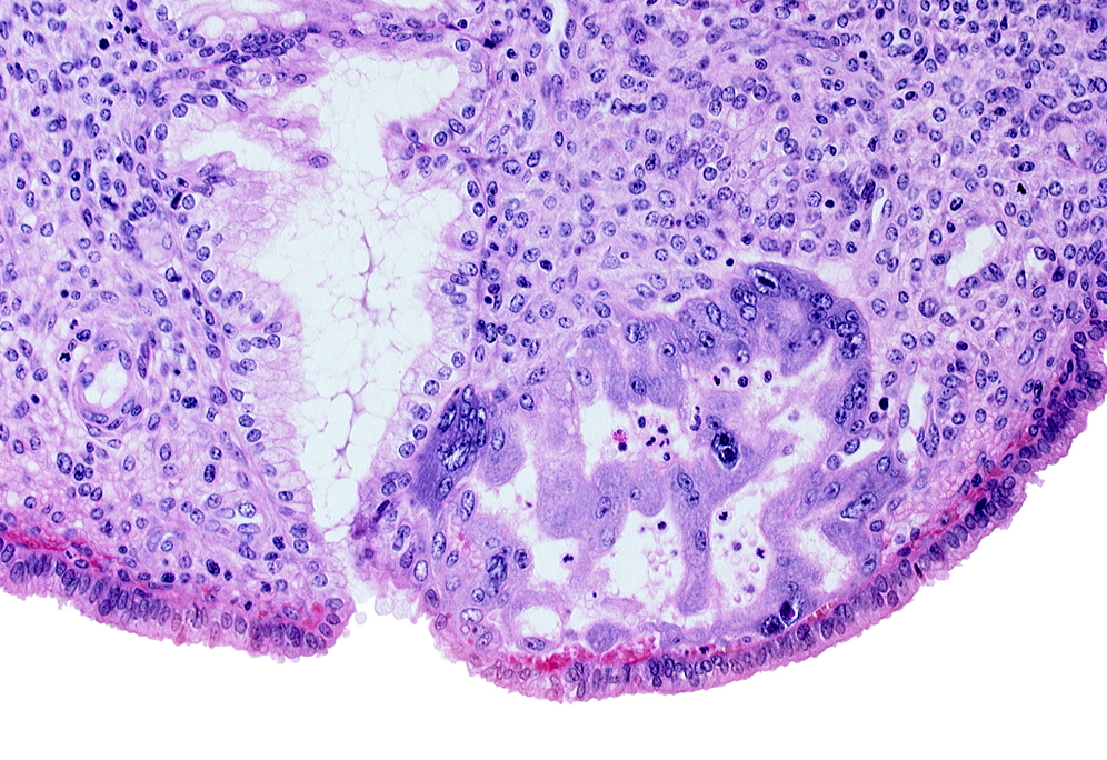 endometrial epithelium, endometrial sinusoid, maternal blood cells in intercommunicating lacunae, mouth of endometrial gland