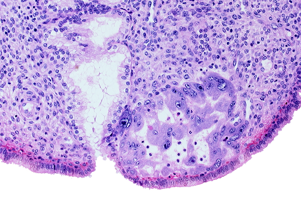 endometrial epithelium, endometrial sinusoid, mouth of endometrial gland