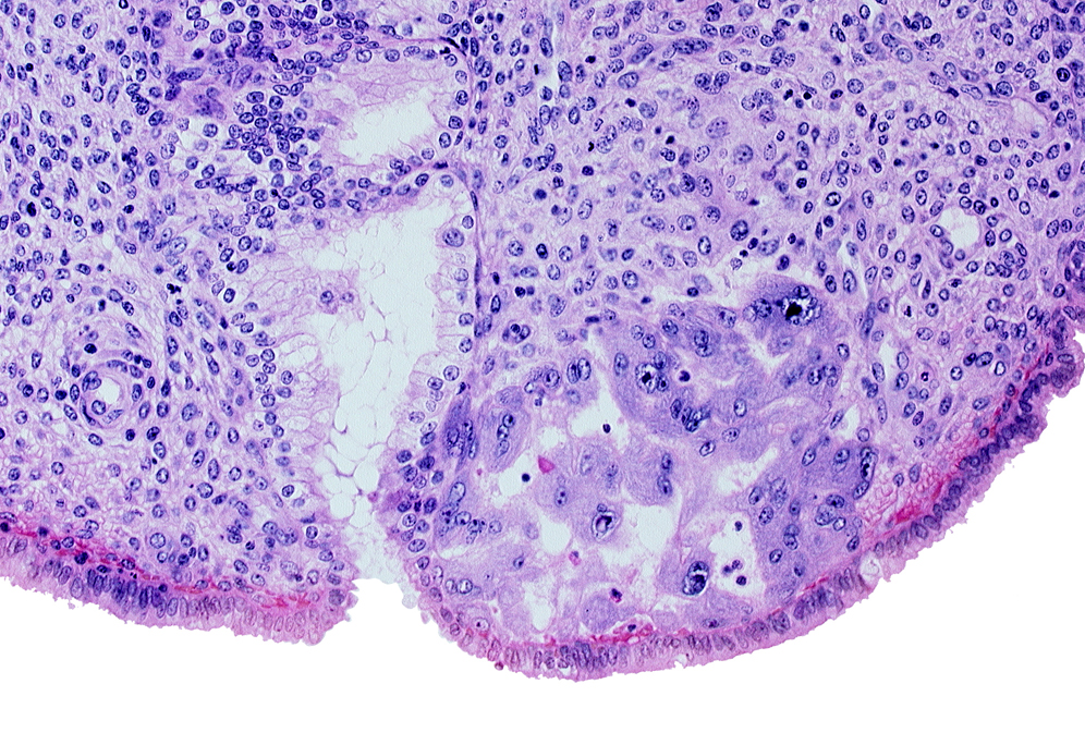 endometrial epithelium, endometrial sinusoid, intercommunicating lacunae, mouth of endometrial gland, syncytiotrophoblast