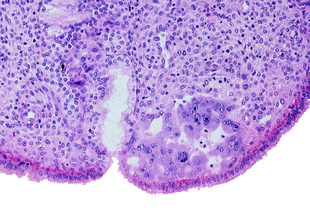 endometrial sinusoid, intact endometrial epithelium, lumen of endometrial gland, mouth of endometrial gland