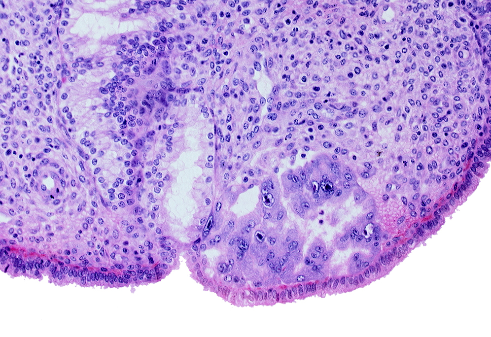 endometrial sinusoid, intact endometrial epithelium, mouth of endometrial gland, syncytiotrophoblast