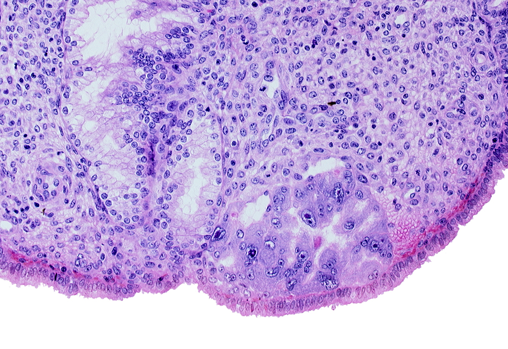 intact endometrial epithelium, lacunae, syncytiotrophoblast