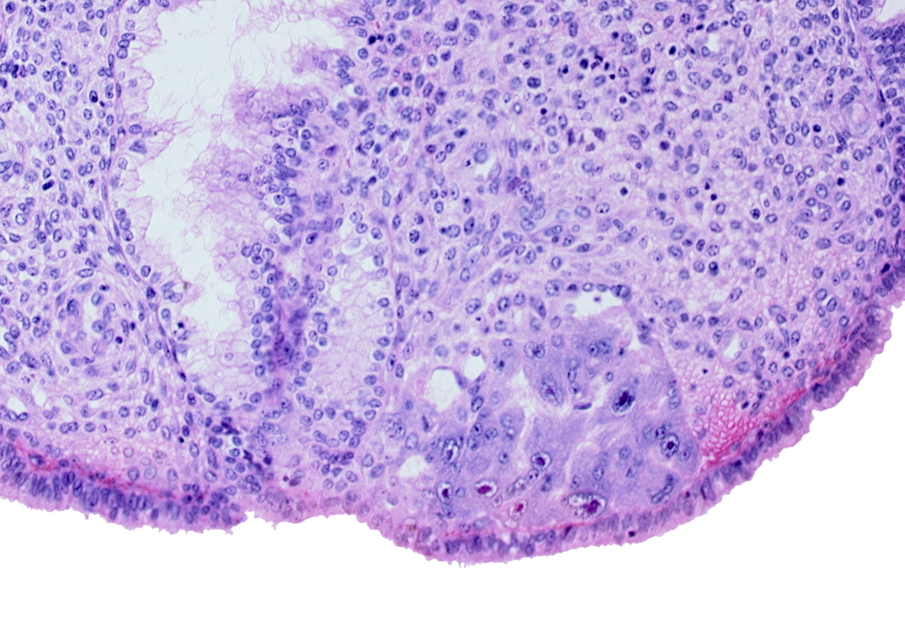 intact endometrial epithelium, lumen of endometrial gland, syncytiotrophoblast