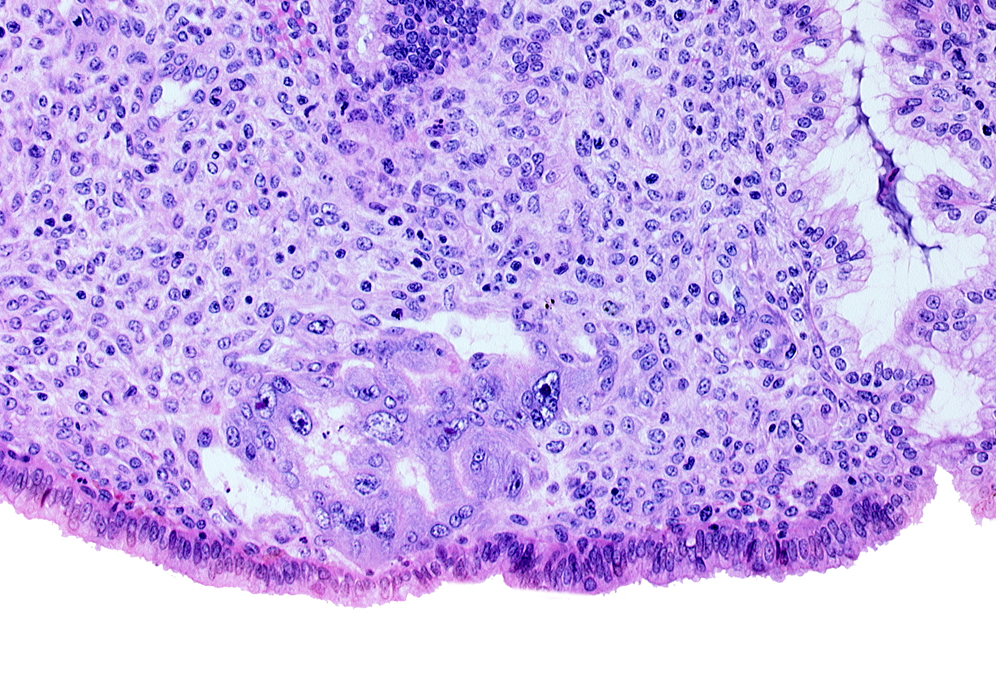 endometrial sinusoid, intact endometrial epithelium, trophoblast lacunae