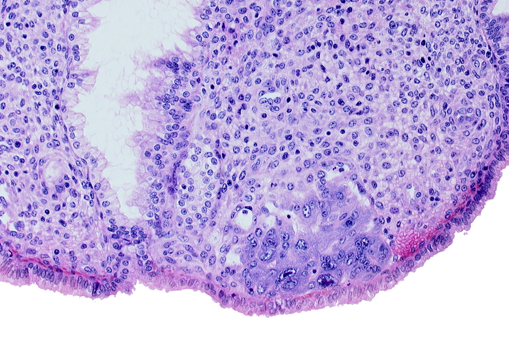 endometrial sinusoid, intact endometrial epithelium, lumen of endometrial gland, syncytiotrophoblast