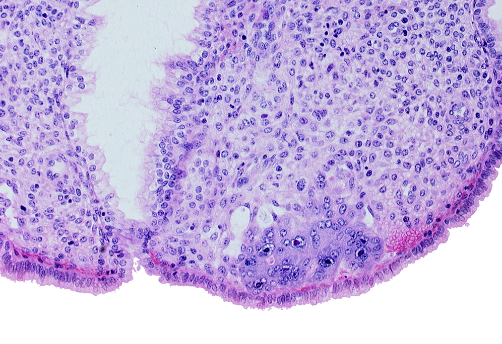 endometrial stroma (decidua), lumen of endometrial gland, syncytiotrophoblast, uterine cavity