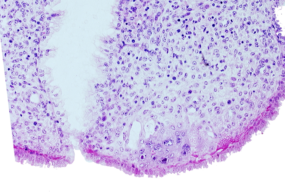 mouth of endometrial gland, syncytiotrophoblast