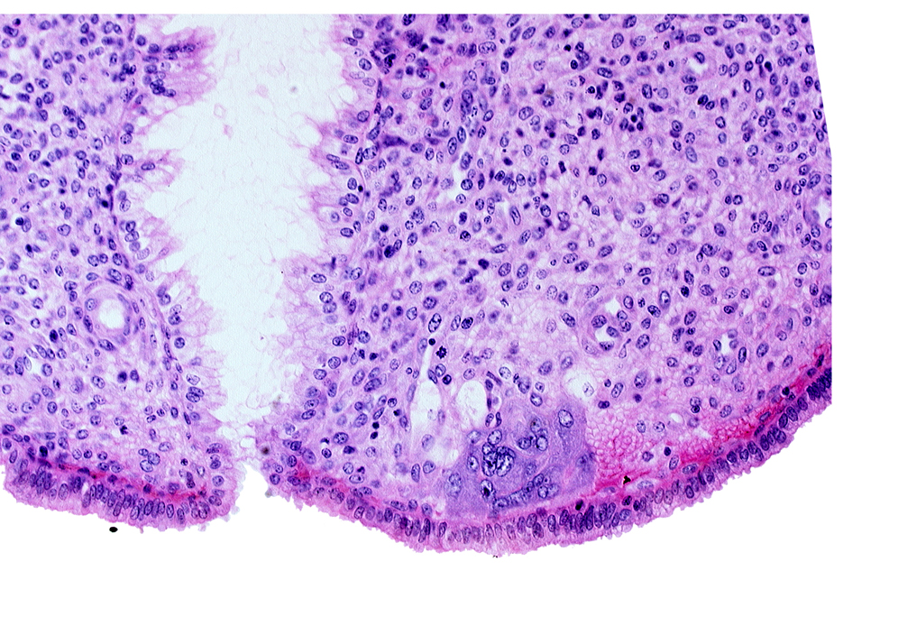 syncytiotrophoblast