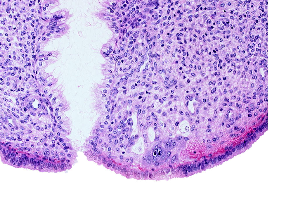 endometrial sinusoid, endometrial stroma (decidua), intact endometrial epithelium, mouth of endometrial gland, syncytiotrophoblast