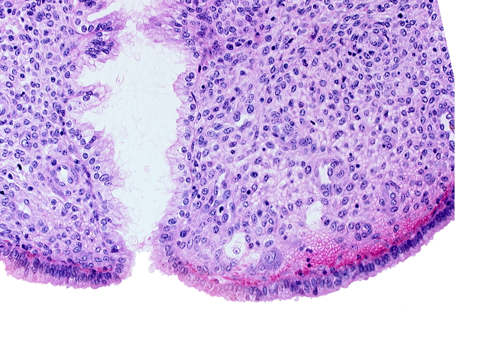 edge of syncytiotrophoblast, endometrial sinusoid, endometrial stroma (decidua), intact endometrial epithelium, lumen of endometrial gland