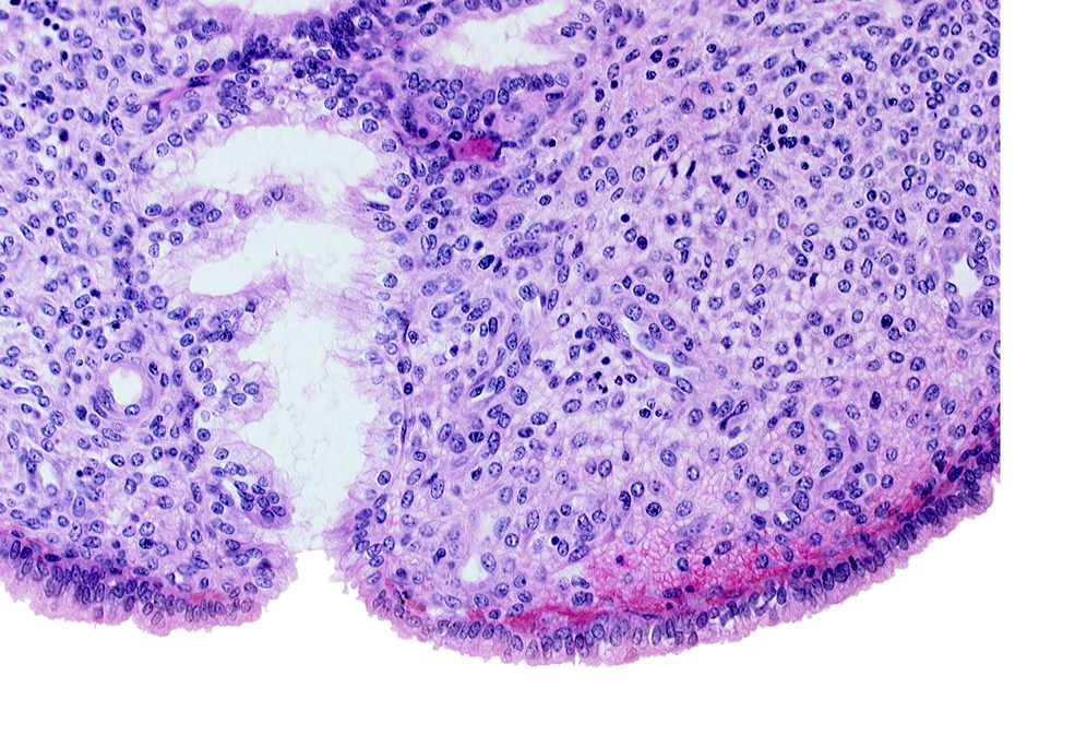 endometrial stroma (decidua), lumen of endometrial gland, mouth of endometrial gland