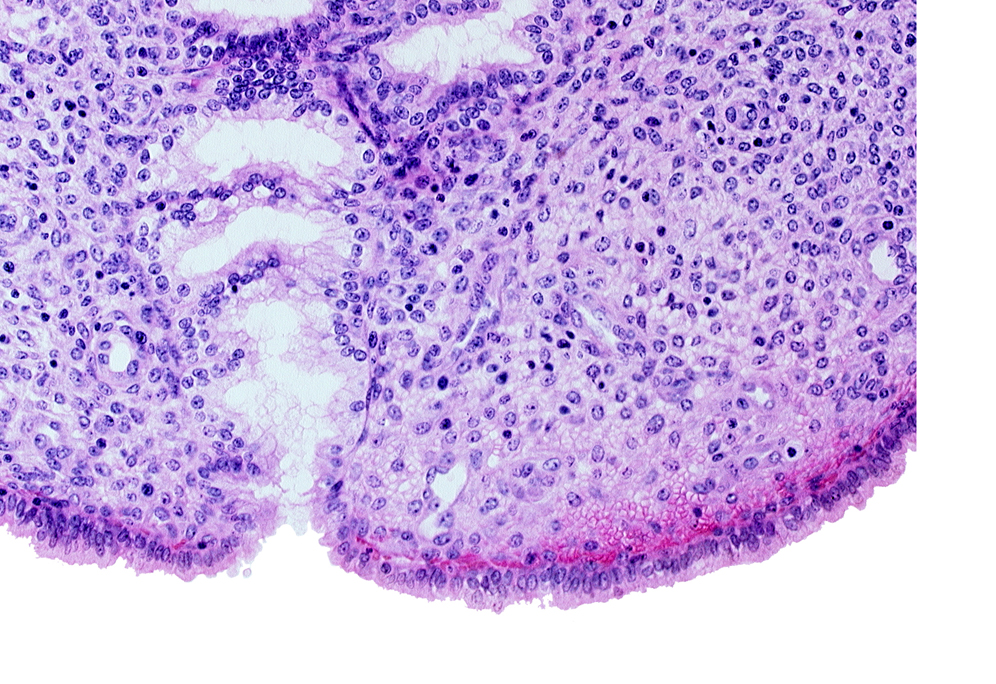 endometrial sinusoid, mouth of endometrial gland