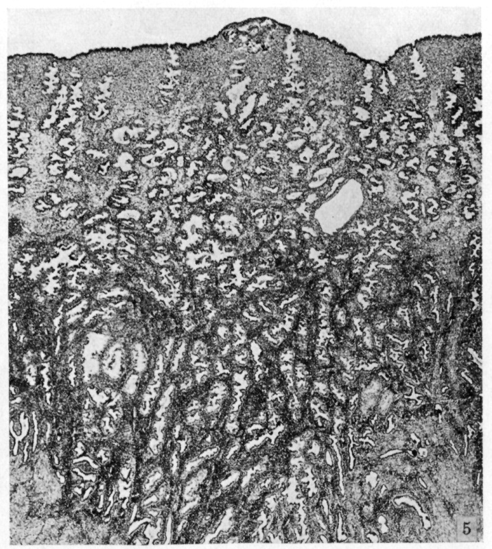 Low-power view of implantation site