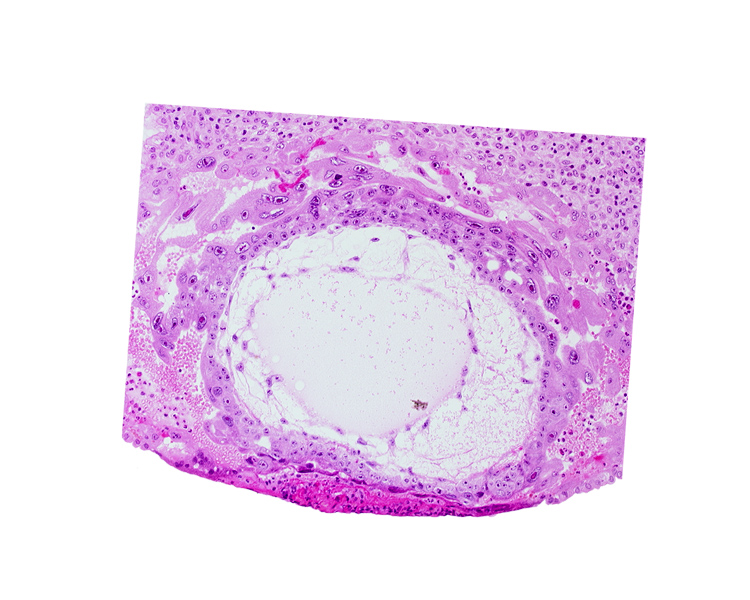 chorionic cavity, definitive exocoelomic (Heuser's) membrane, extra-embryonic mesoblast, primary umbilical vesicle cavity