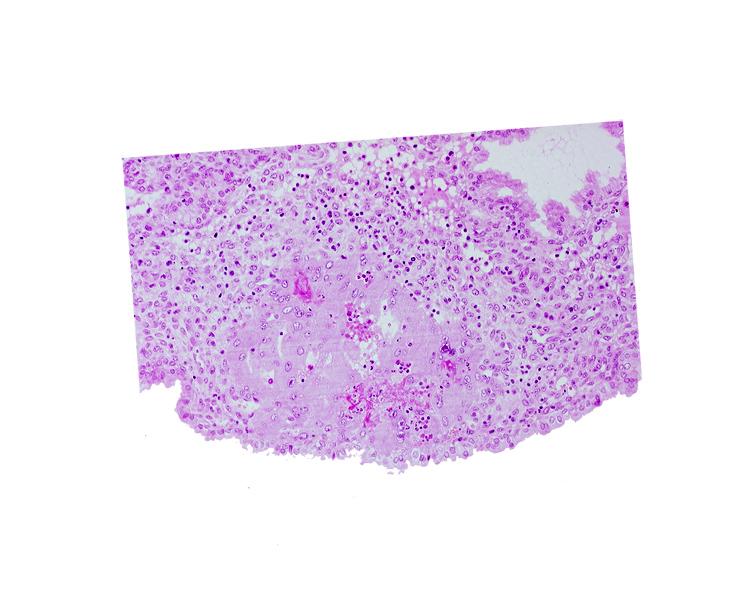 endometrial epithelium, lumen of endometrial gland, maternal blood cells in trophoblast lacuna, uterine cavity