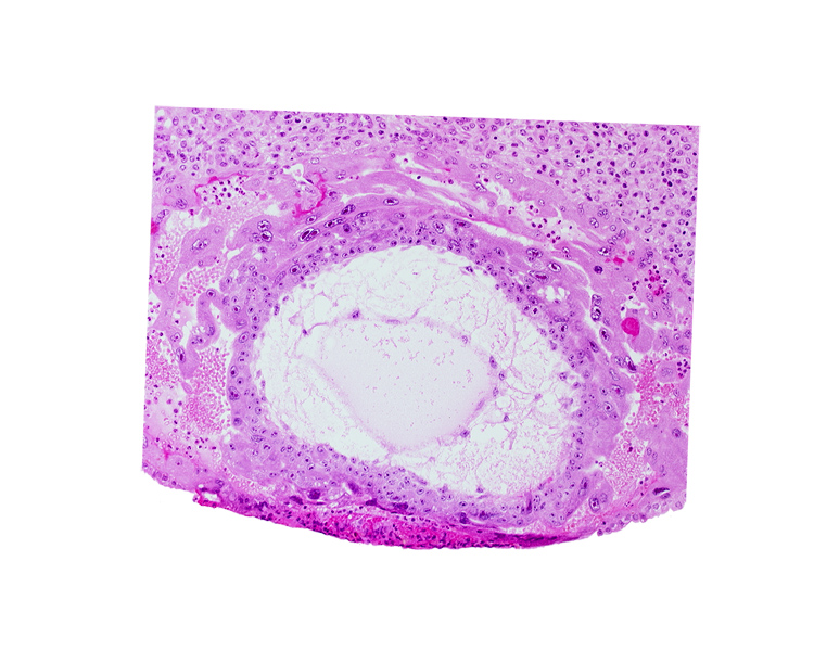 chorionic cavity, syncytiotrophoblast, uterine cavity