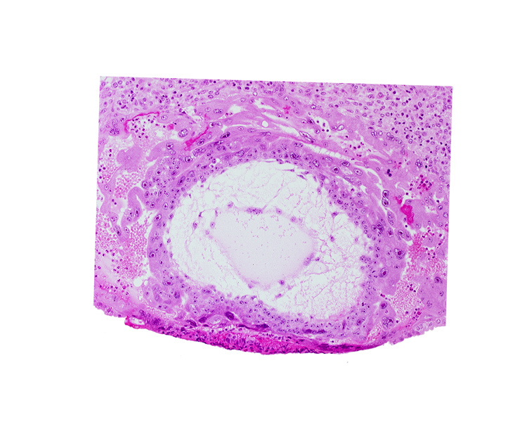 chorionic cavity, syncytiotrophoblast, uterine cavity