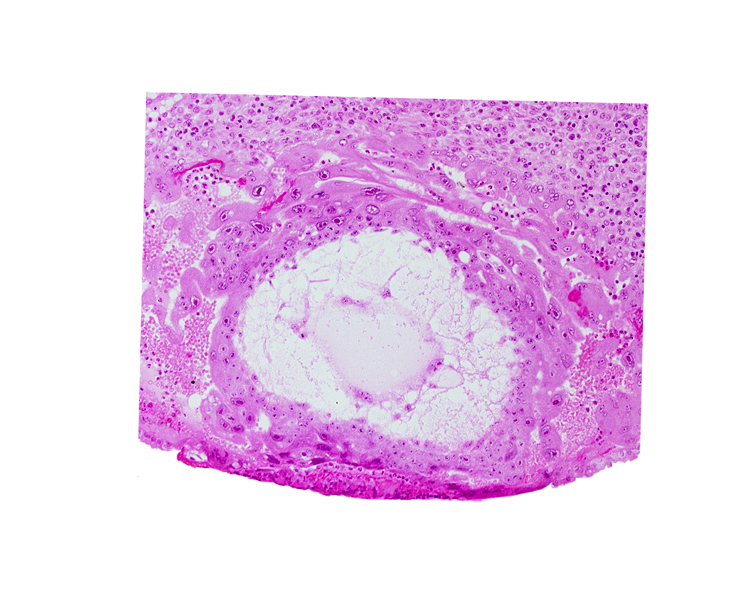 chorionic cavity, edge of primary umbilical vesicle cavity, extra-embryonic mesoblast, fibrous coagulum, syncytiotrophoblast, uterine cavity