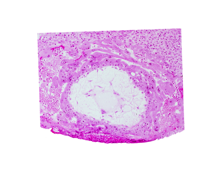 chorionic cavity, extra-embryonic mesoblast, fibrous coagulum, syncytiotrophoblast, uterine cavity