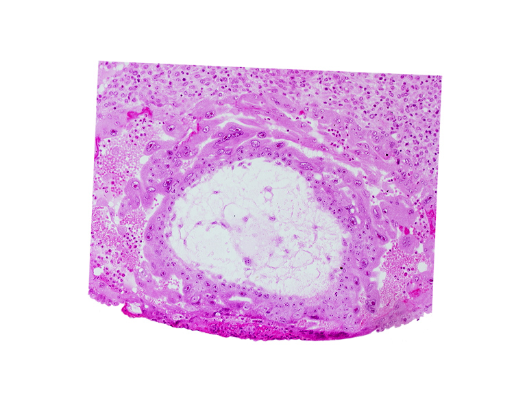 extra-embryonic mesoblast, fibrous coagulum, syncytiotrophoblast