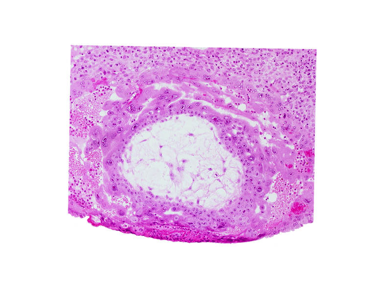 cytotrophoblast, extra-embryonic mesoblast, extra-embryonic reticulum, fibrous coagulum, lacunar vascular circle with maternal blood cells, syncytiotrophoblast, uterine cavity