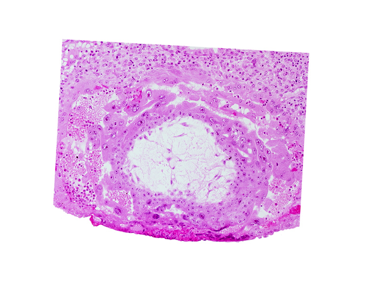 chorionic cavity, extra-embryonic mesoblast, lacunar vascular circle with maternal blood cells, syncytiotrophoblast