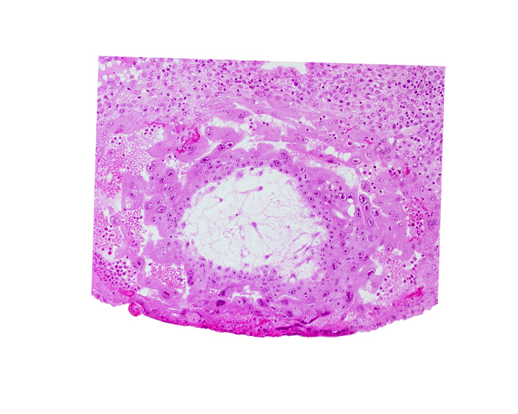 extra-embryonic reticulum, fibrous coagulum, lacunar vascular circle with maternal blood cells, uterine cavity