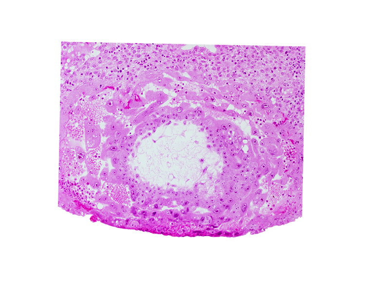 extra-embryonic reticulum, lacunar vascular circle with maternal blood cells, uterine cavity